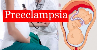 Преэклампсия - что это?